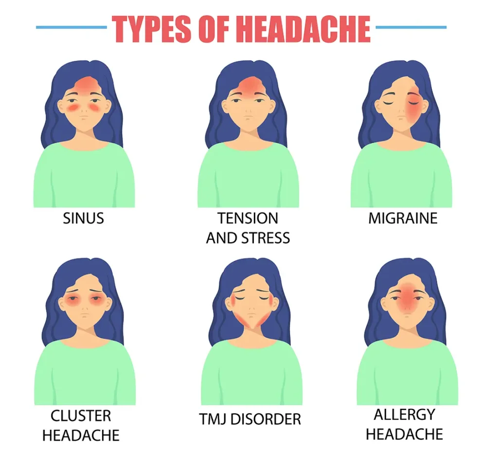 7 Painful Ways Teeth Grinding Impacts Your Oral Health 1 Illustration depicting different types of headaches, including TMJ disorder linked to teeth grinding, a condition treated at Montana Center for Implants and Dentures for better oral health.