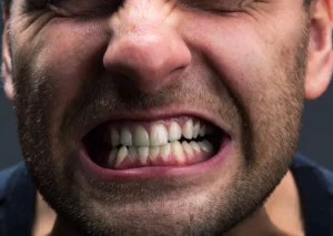 Close-up of a man showing symptoms of teeth grinding, a condition treated at Montana Center for Implants and Dentures to maintain oral health.