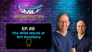 Montana Center for Implants and Dentures podcast episode discussing the risks and trends of DIY Dentistry, featuring expert insights in episode #6 of 'Smile Reconstruction: The Dental Implant Podcast.'