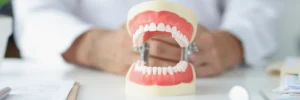 Artificial model of full-mouth dental implants on a table at Montana Center for Implants and Dentures, representing advanced dental treatment and smile makeover procedures.