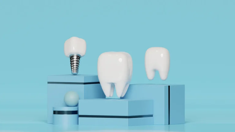 3D illustration of dental implants and natural teeth on a blue background, representing dental implants in Billings, MT.