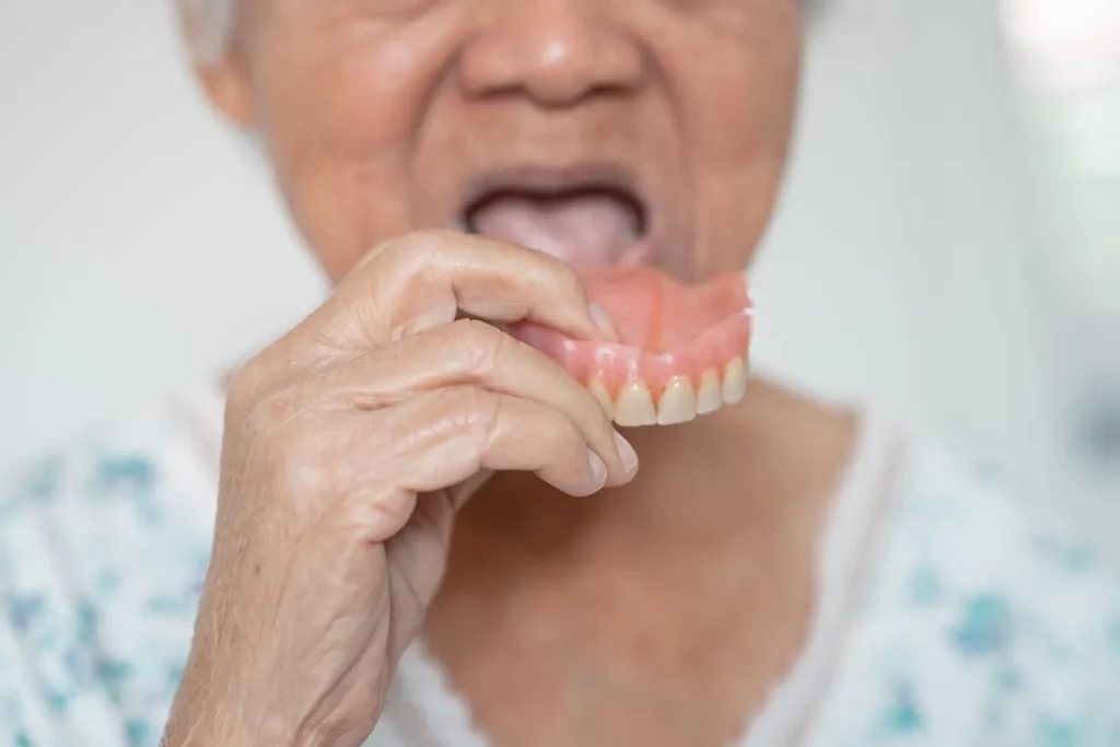 Elderly woman holding upper denture before insertion, demonstrating proper denture adjustments for comfort and fit.