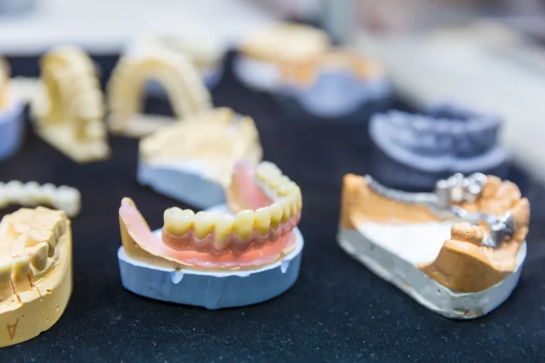 Various types of dentures displayed on dental molds, showcasing different denture options for tooth replacement.