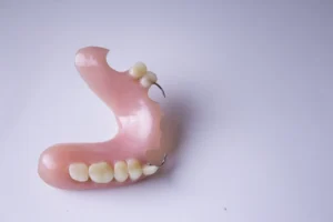 Close-up of a broken partial denture on a white background, highlighting the need for denture repair.