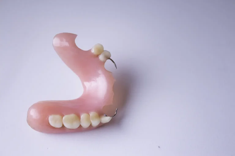 Close-up of a broken partial denture on a white background, highlighting the need for denture repair.